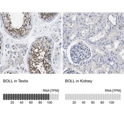 Boll Antibody, Novus Biologicals:Antibodies:Primary Antibodies